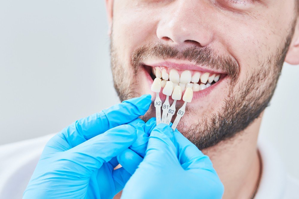 precio implante dental barcelona